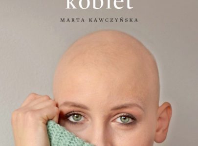 ALOPECJANKI – historie łysych kobiet